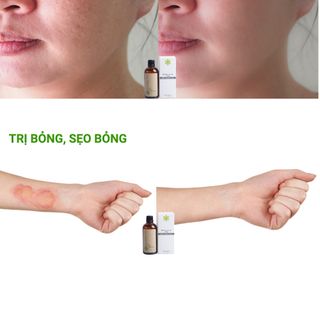 FREE SHIP Mỡ Trăn Giá Sỉ Cháy Hàng Liên Tục Không Lo Tồn Hàng Lợi Nhuận Cao