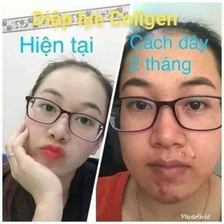 diệp lục collagen giá sỉ