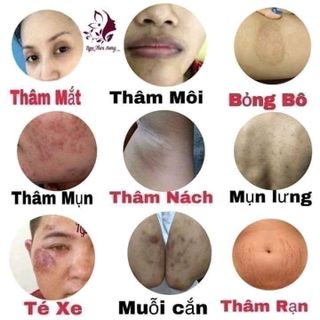 Tinh dầu