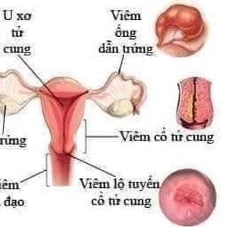 ladycare