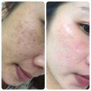 Tái tạo da Thảo dược nhân sâm