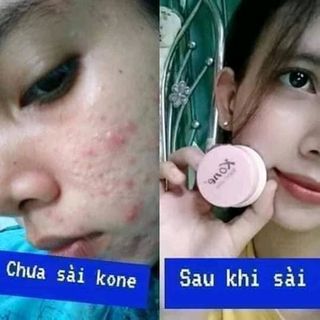 Chọn KONÉTHÁI ngay hôm nay để làn da trẻ khỏe đẹp mịn màng hơn từng ngày 
Chỉ 1 lớp kem face dưỡng mỏng nhẹ nuôi dưỡng da trẻ hóa mỗi ngày 
Thoa kem trước khi đi ngủ và mỗi sáng thức dậy nhé 
KONÉ THÁI LAN giúp LÀNDA bạn xinh đẹp hơn từng ngày giá sỉ