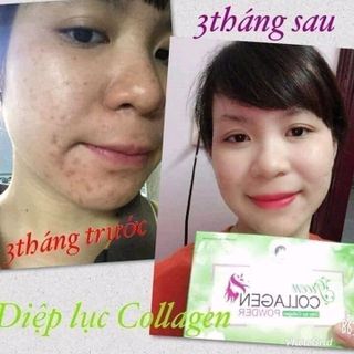 DIỆP LỤC COLLAEN