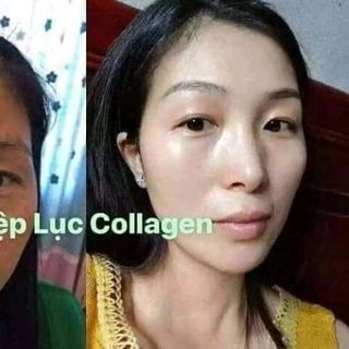 DIỆP LỤC COLLAEN