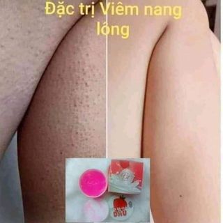 TẨY TẾ BÀO CHẾT BT