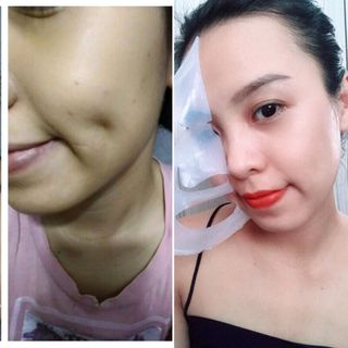 Mặt nạ quốc dân muing lab