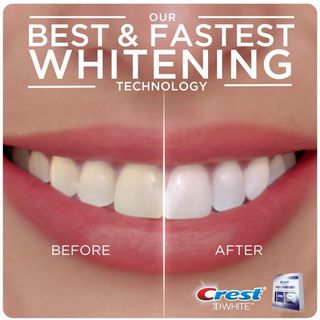 Bộ Sản Phẩm Tẩy Trắng Răng Kèm Đèn Crest 3D White Whitestrips with Light