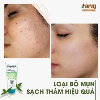 Tẩy tế bào chết thanh tẩy da lá Neem Ấn Độ 100ml