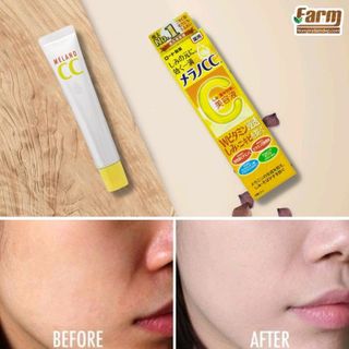 Tinh chất vitamin C tinh khiết dưỡng trắng và mờ thâm CC MELANO - 20ml