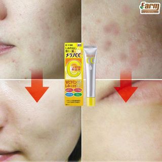 Tinh chất vitamin C tinh khiết dưỡng trắng và mờ thâm CC MELANO - 20ml