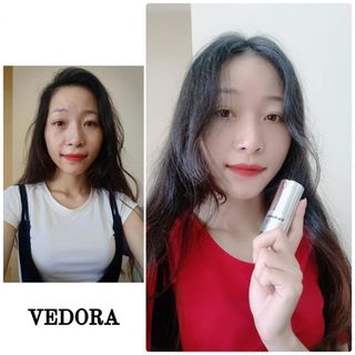 Kem dưỡng trắng da mặt cao cấp Vedora