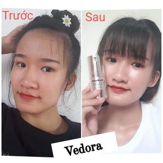 Kem dưỡng trắng da mặt cao cấp Vedora
