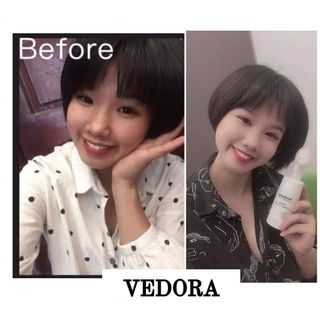 Sữa rửa mặt ngừa mụn thải độc trắng da Vedora