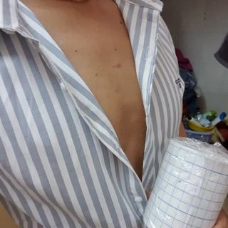 Keo Dán Ngực Dành Cho Sb Trans Tom LGBT