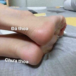 Kem chuối trị nứt gót chân Thái lan