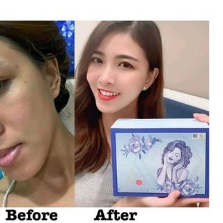 beutyplus-beauty99