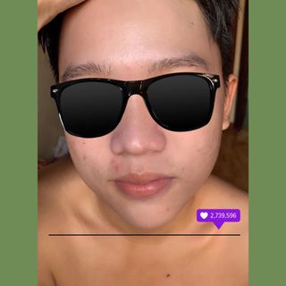 Thải chì da amel 2s