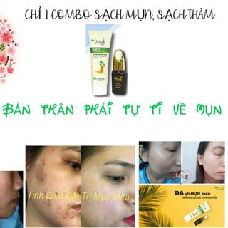 Serum Trị Mụn Thiên Nhiên Mita - Hiệu Quả Sau 7 Ngày Sử Dụng
