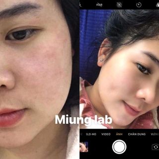 nạ muing lab