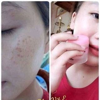 collagen vit E