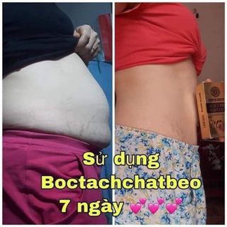 Bóc tách chất béo-Hàng chuẩn công ty