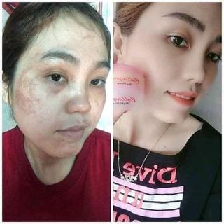 KEM COLAGEN PLUS VIT E từ Malaysia