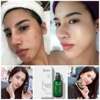 Thay Da Nhân Sâm Hàn Quốc-MQ Skin