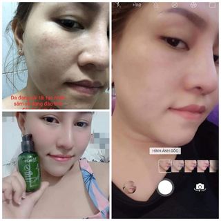 Thay Da Nhân Sâm Hàn Quốc-MQ Skin