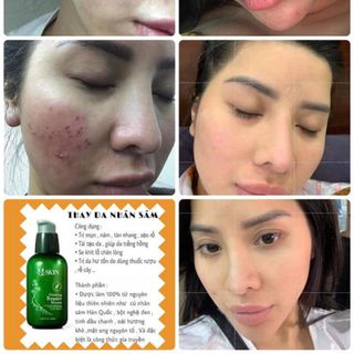Thay Da Nhân Sâm Hàn Quốc-MQ Skin