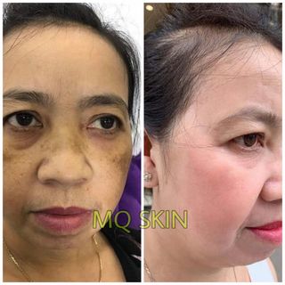 Thay Da Nhân Sâm Hàn Quốc-MQ Skin