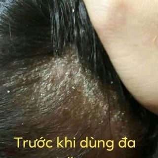 Kem Đa Năng Bà Vân
