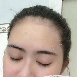 TẨY TẾ BÀO CHẾT DÂU BT COSMETIC