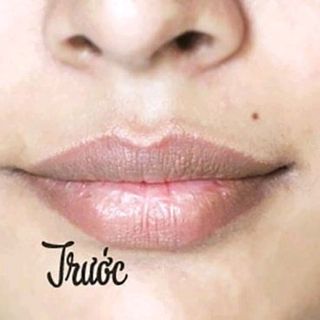ủ môi collagen