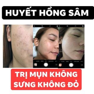 Hồng huyết sâm
