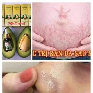 Tinh dầu bơ Nguyên chất