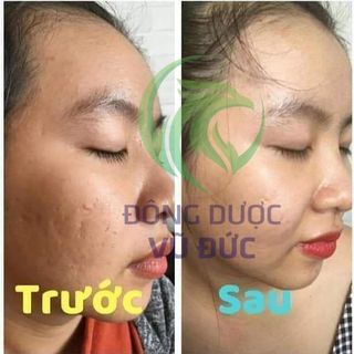 Huyết Hồng Sâm