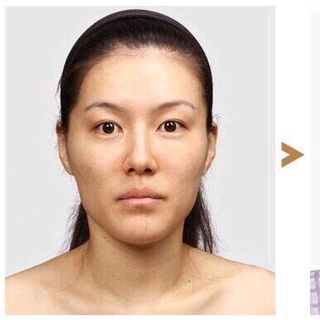 Kem nâng cơ mặttan mỡ cằm