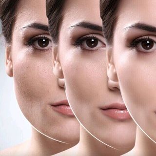 Kem nâng cơ mặttan mỡ cằm