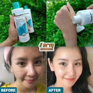 Nước hoa hồng thanh tẩy và sáng da Hymalaya 175ml