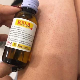 Đặc trị viêm lỗ chân lông KELA LOTION Thailand 60ml