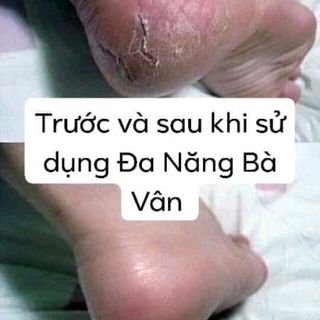 KEM ĐA NĂNG BÀ VÂN