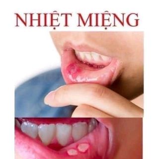 KEM ĐA NĂNG BÀ VÂN