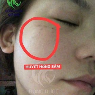Huyết Hồng Sâm Vũ Đức