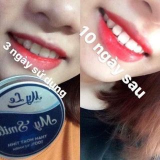 Than hoạt tính my smile