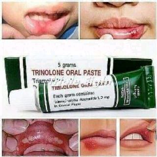 KEM TRỊ NHIỆT MIỆNG THÁI LAN