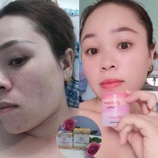 kem collagen plus vit e
