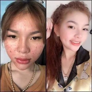 kem collagen plus vit e