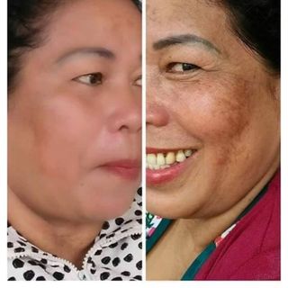 kem collagen plus vit e