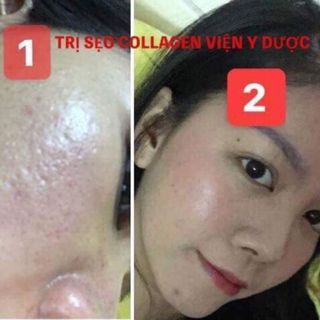 VUA TRỊ SẸO COLLAGEN DREVA