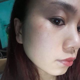 VUA TRỊ SẸO COLLAGEN DREVA
